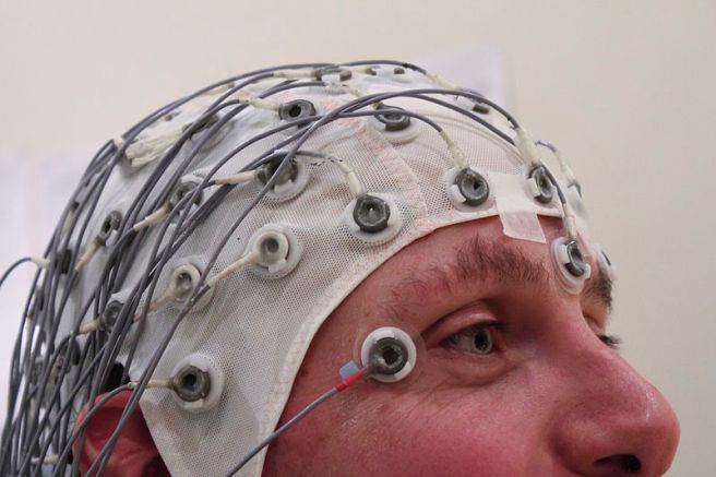 Epilepsija